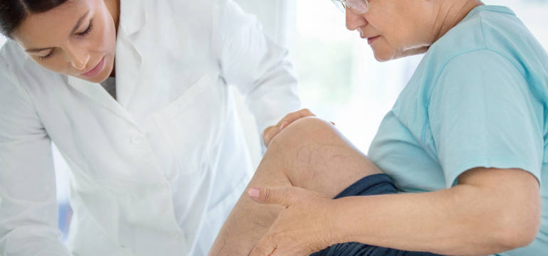 Usuwanie żylaków metodą EVRF w Poradni Flebologicznej