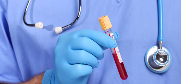 Hematolog Mieczysław Komarnicki wyjaśnia: jak rozpoznać anemię?