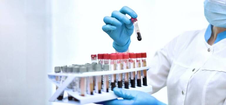 Indywidualna Specjalistyczna Praktyka Lekarska Lek. Med. Wojciech Baran: Kiedy warto udać się do hematologa?