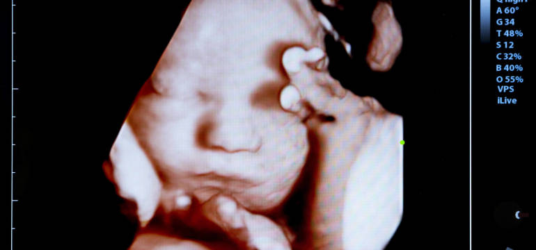 W jakim celu wykonuje się trójwymiarowe USG 4D?