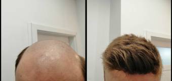 TomHair – fryzjer, który zrozumie każdego mężczyznę