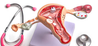 Dlaczego warto zdecydować się na leczenie mięśniaków macicy w gabinecie ginekologicznym w przychodni Medikarte?