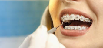 Czym dokładnie zajmuje się ortodonta z Family-Dent?