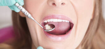  Zainwestuj w piękny uśmiech udając się do Stomatologa Henryki Jasionowskiej