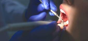 Leczenie miejscowych stanów zapalnych ozonoterapią - nowoczesne podejście w gabinetach stomatologicznych. Iwodent 