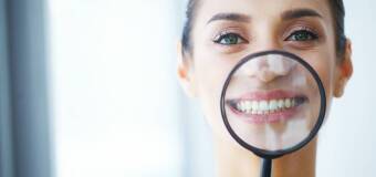 Stomatologia zachowawcza - Gabinet Stomatologiczny Nowodent w Warszawie