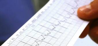 Badanie EKG w diagnozowaniu arytmii serca