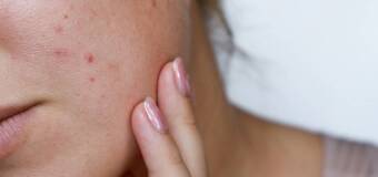 Zabiegi na twarz i trądzik w salonie kosmetycznym