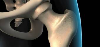 Dysplazja stawu biodrowego – nowoczesne metody diagnozy