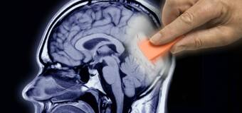 Neurochirurgia w Poliklinice Doktora Bessera