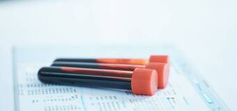 Konsultacje hematologiczne w Poznaniu