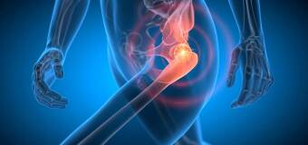 Plastyka stawu biodrowego - Marek Hawranek Gabinet Ortopedyczny