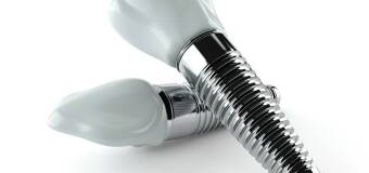 Implantologia stomatologiczna – Es-Dent Gabinet Stomatologiczny