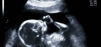 Diagnostyka prenatalna - Danuta Kardzis Gdańsk