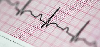 Jak przygotować się do badań okresowych dla kierowców zawodowych — rola diagnostyki neurologicznej i EKG
